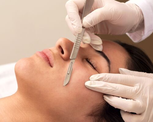 dermaplaning